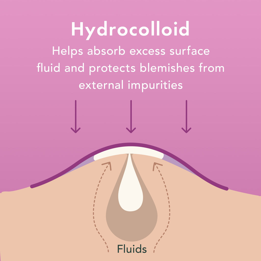 Miracle Patch Overnight Spot Cover